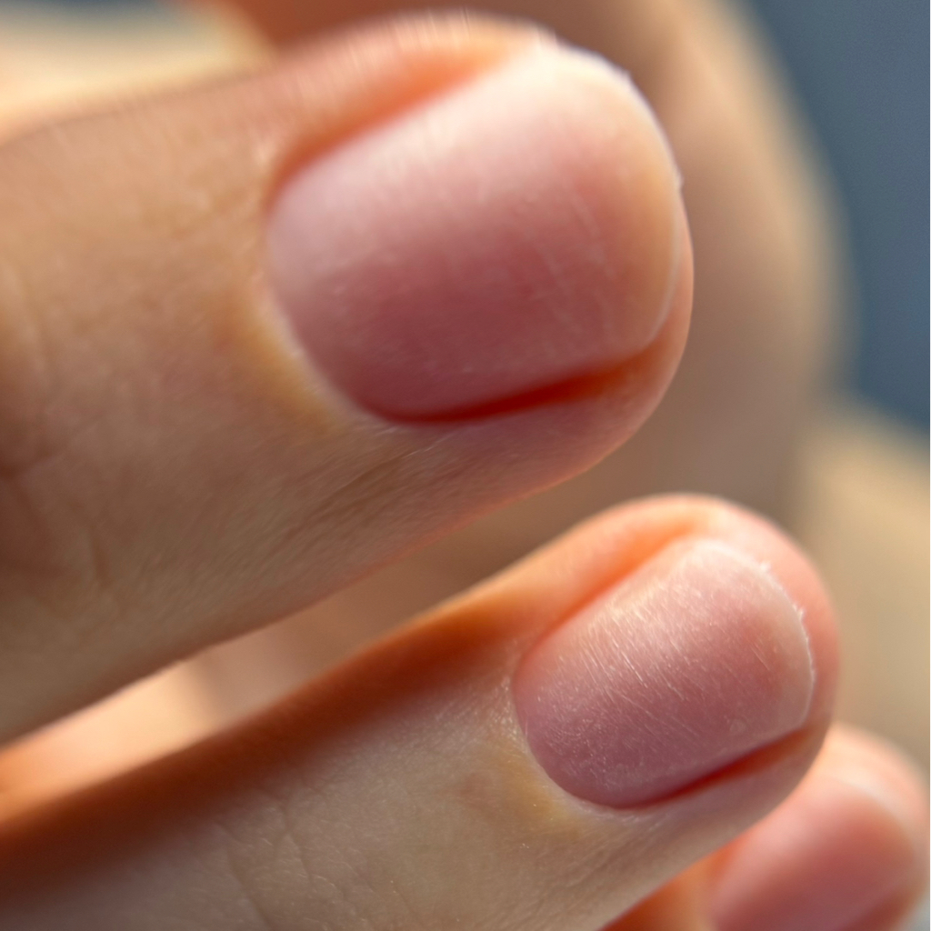 Снятие без последующего покрытия