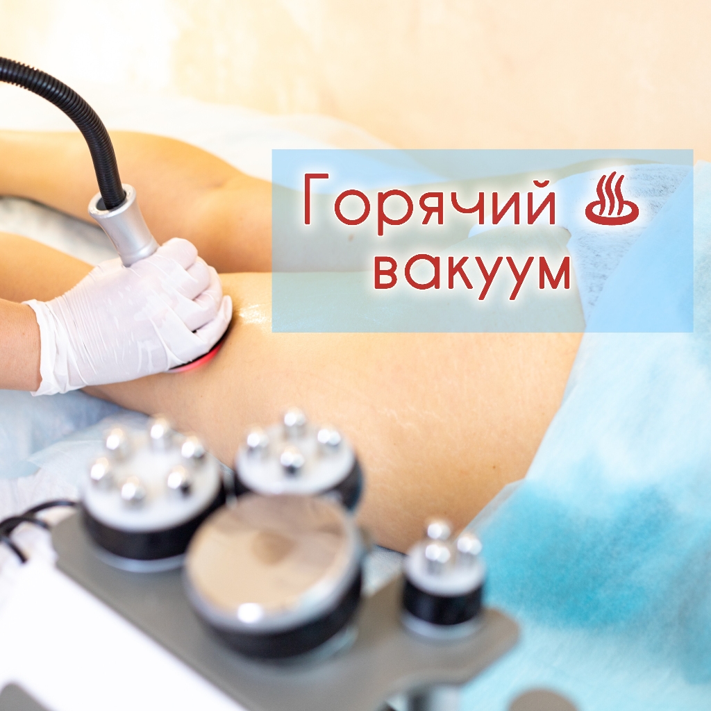 Горячий вакуумный массаж курс 10 сеансов