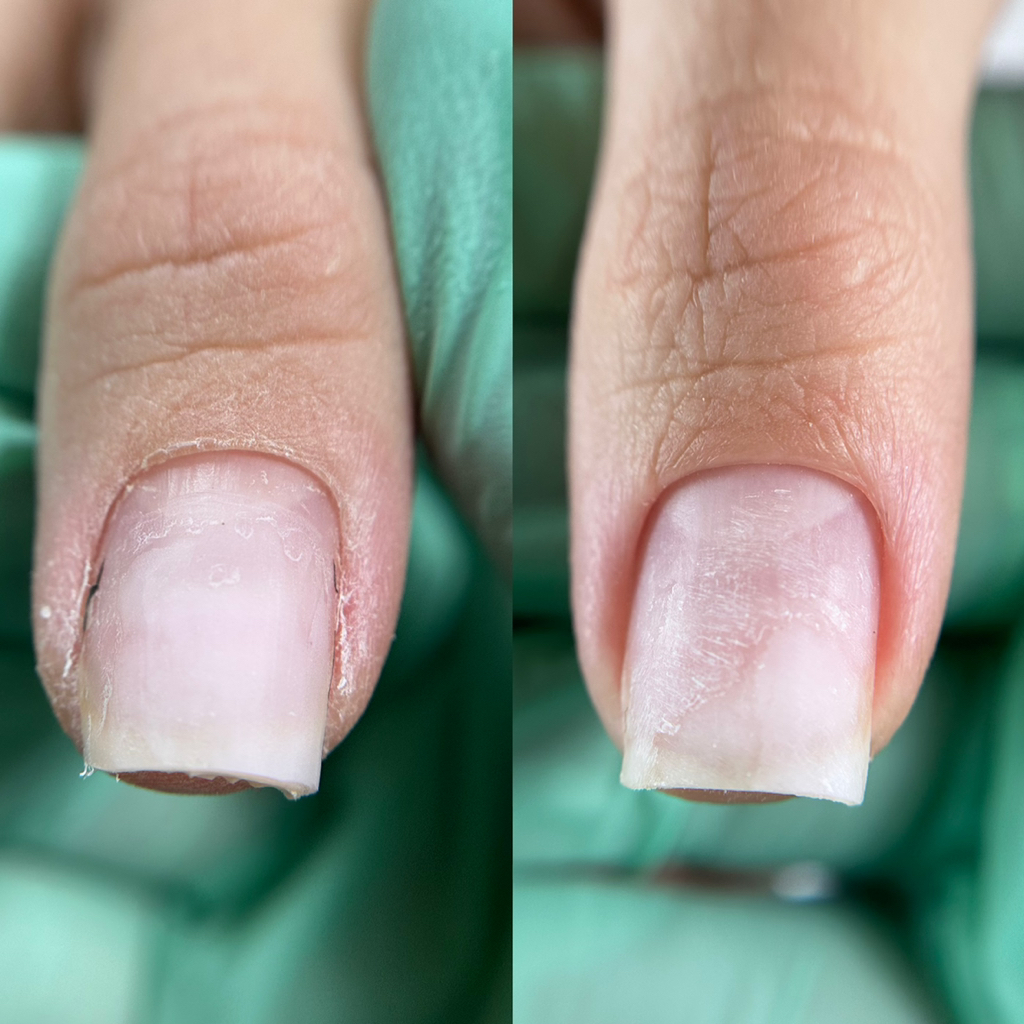 Снятие старого покрытия + маникюр (обработка кутикулы, формы, без последующего покрытия)