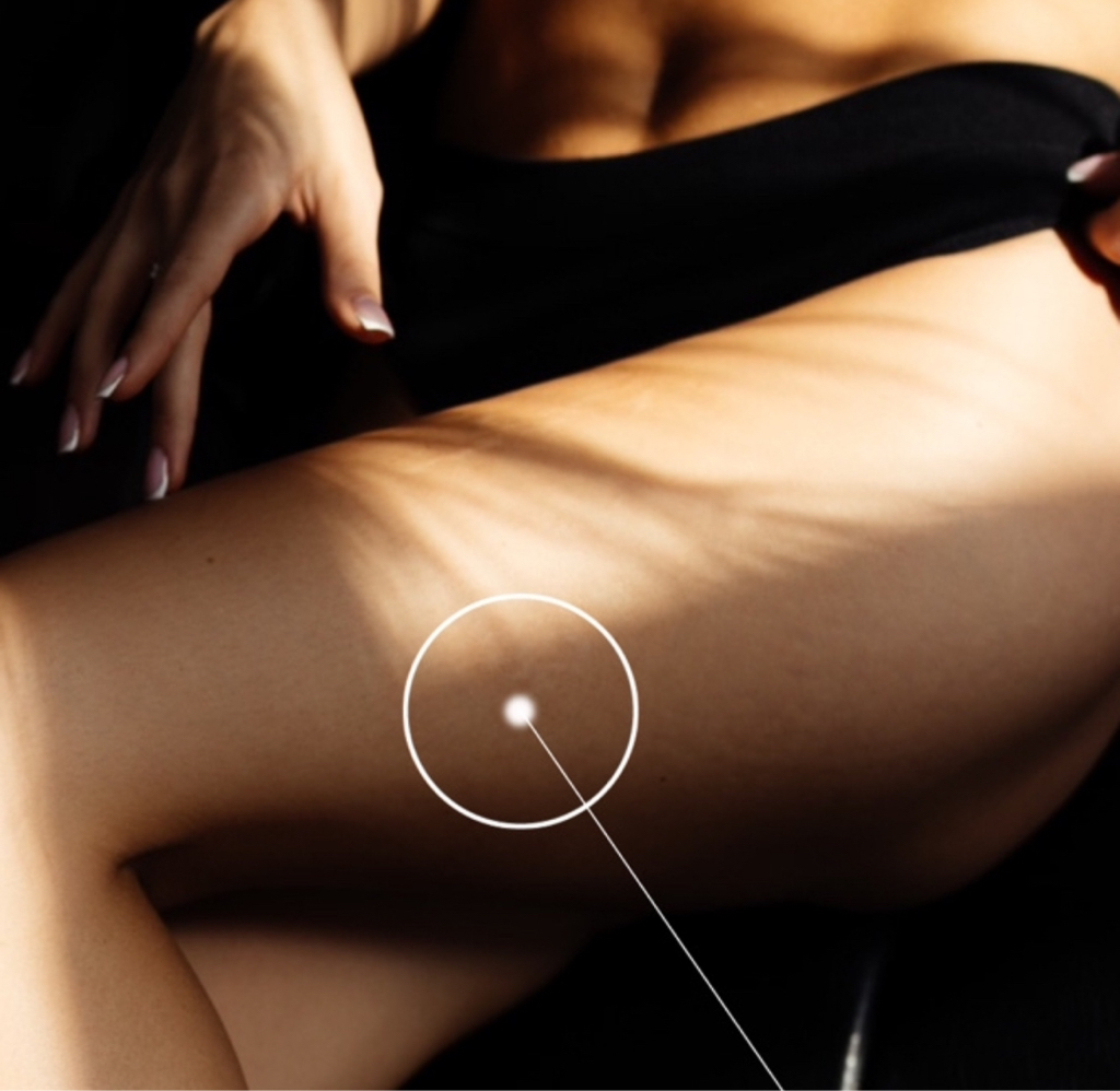 Бёдра + тотальное бикини + подмышечные впадины