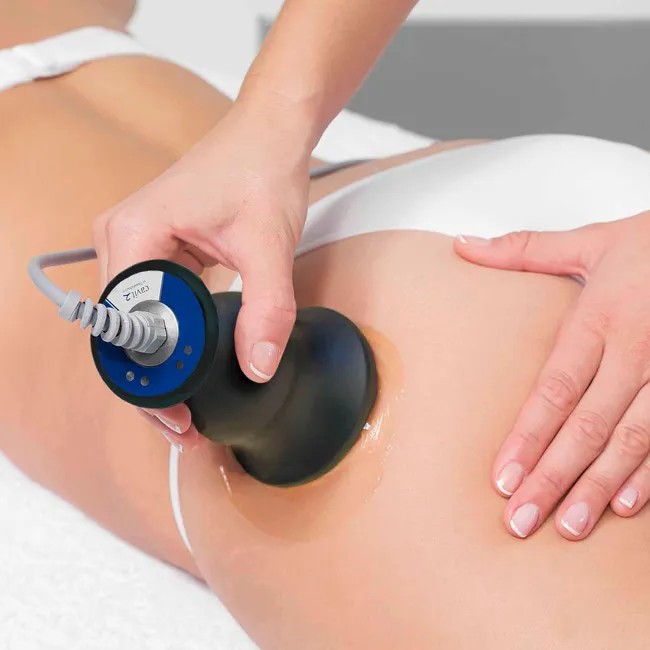 кавитация бедра