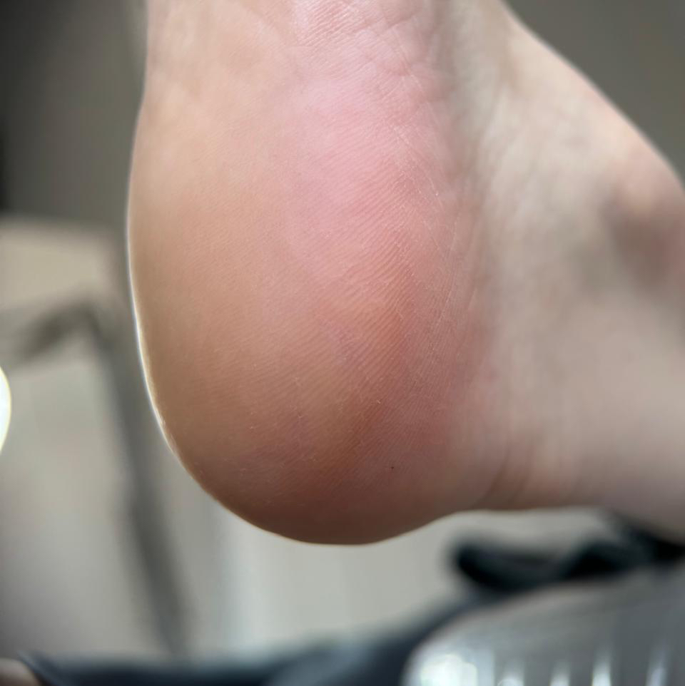 Гигиенический педикюр SMART