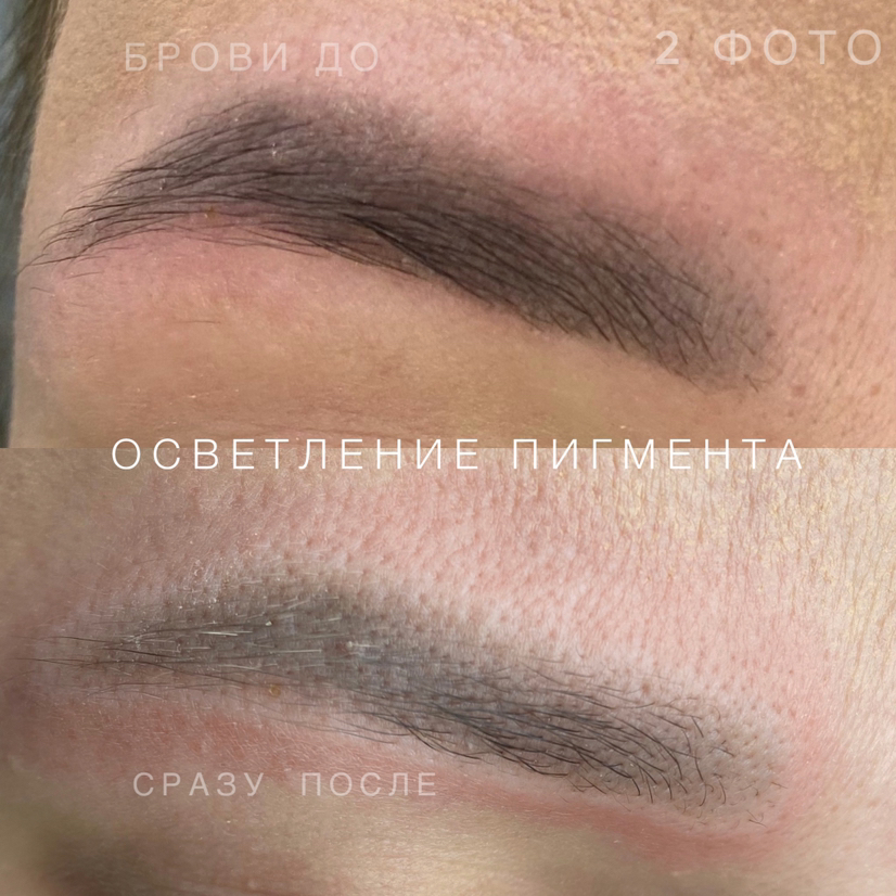Осветление Ремувер