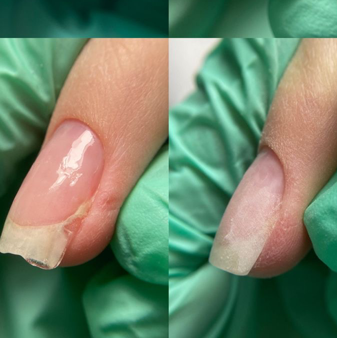 Ремонт ногтя (только моя работа)