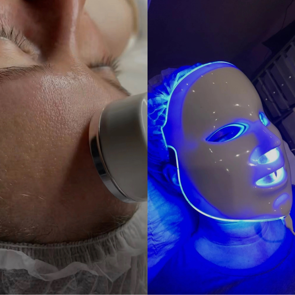 Безинъекционная мезотерапия