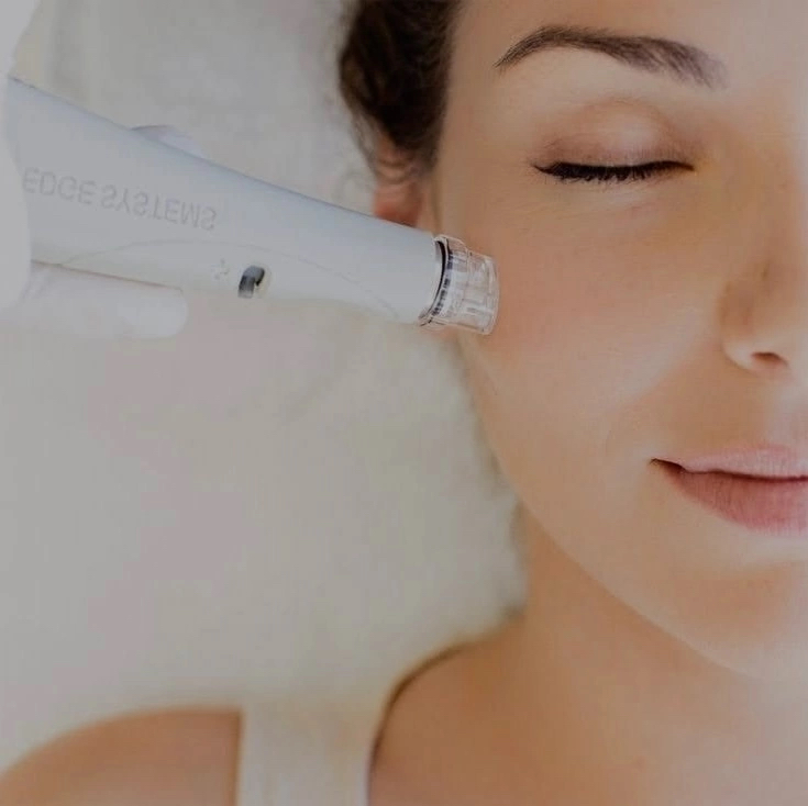 Вакуумная чистка лица