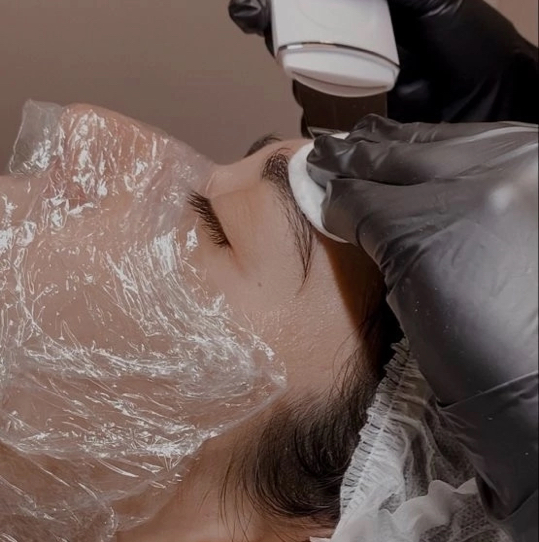 Ультразвуковая чистка лица