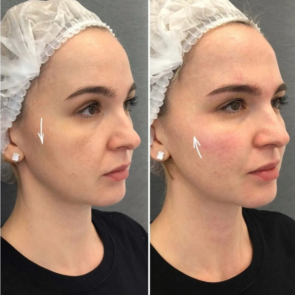 Щечки-яблочки 2мл