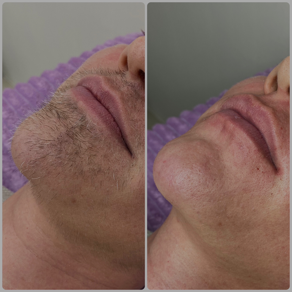 Борода мужская