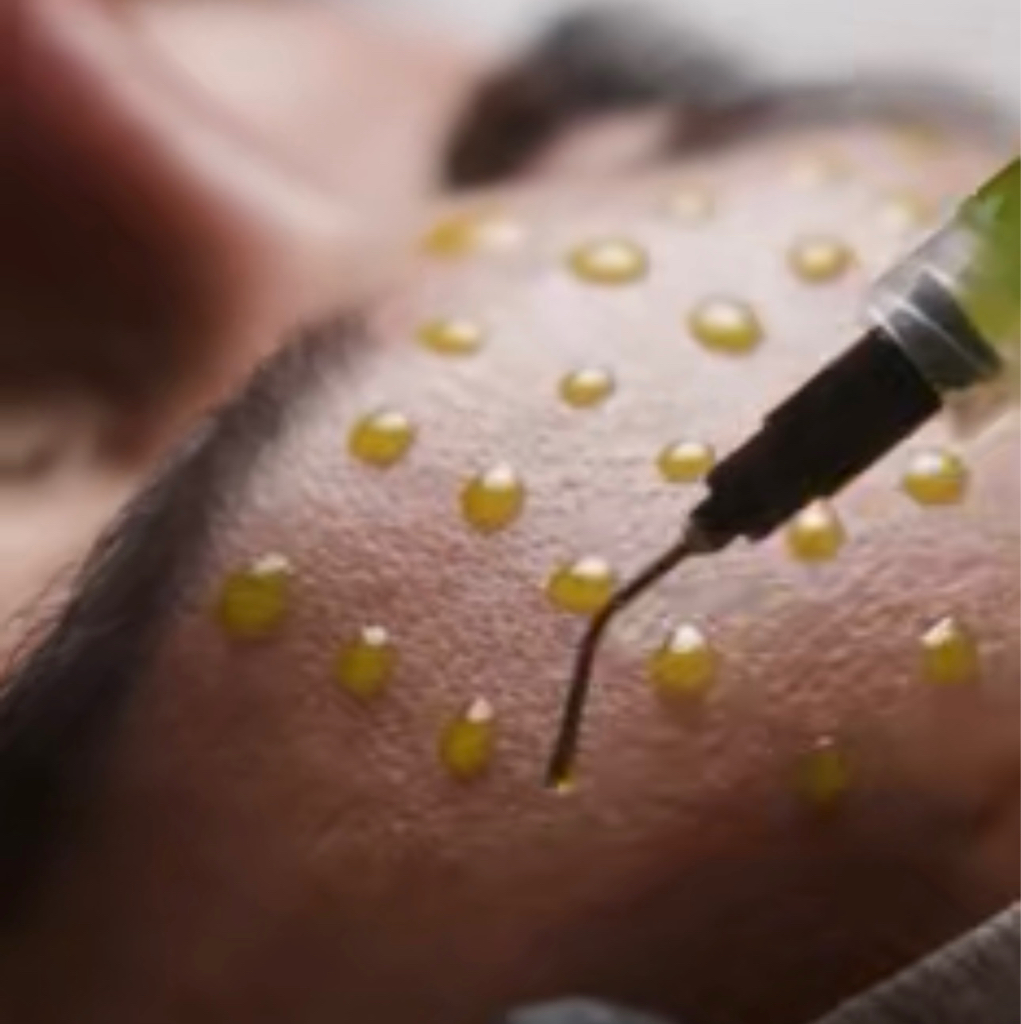 Пилинг BioRePeel