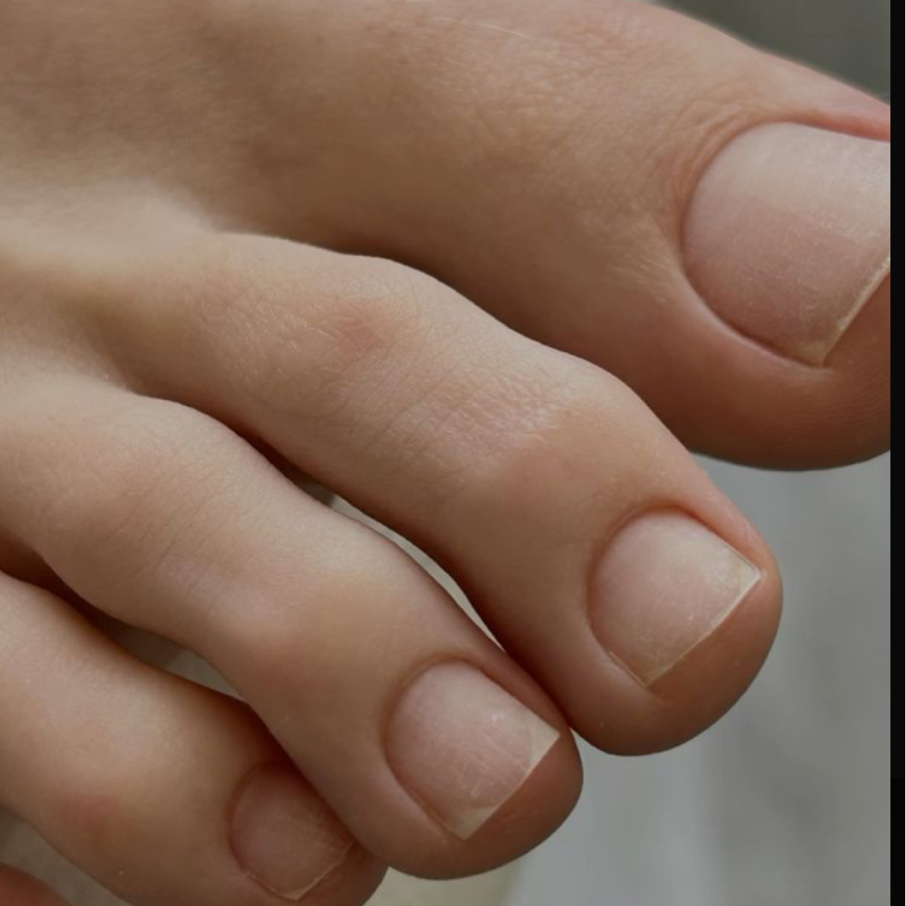 Педикюр (обработка пальчиков)