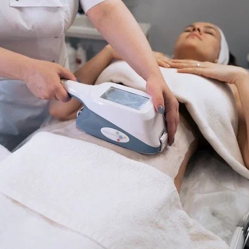 Криолиполиз