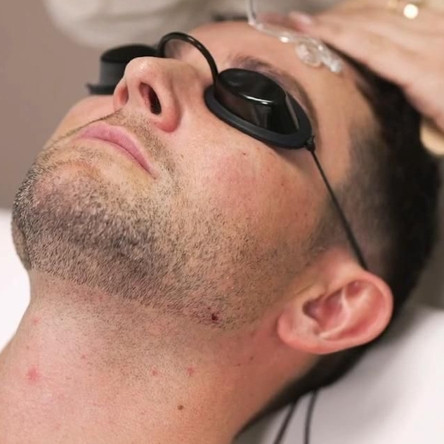 Лазерная эпиляция Шея муж