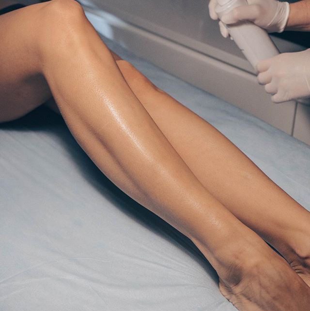 Лазерная эпиляция Ноги полностью