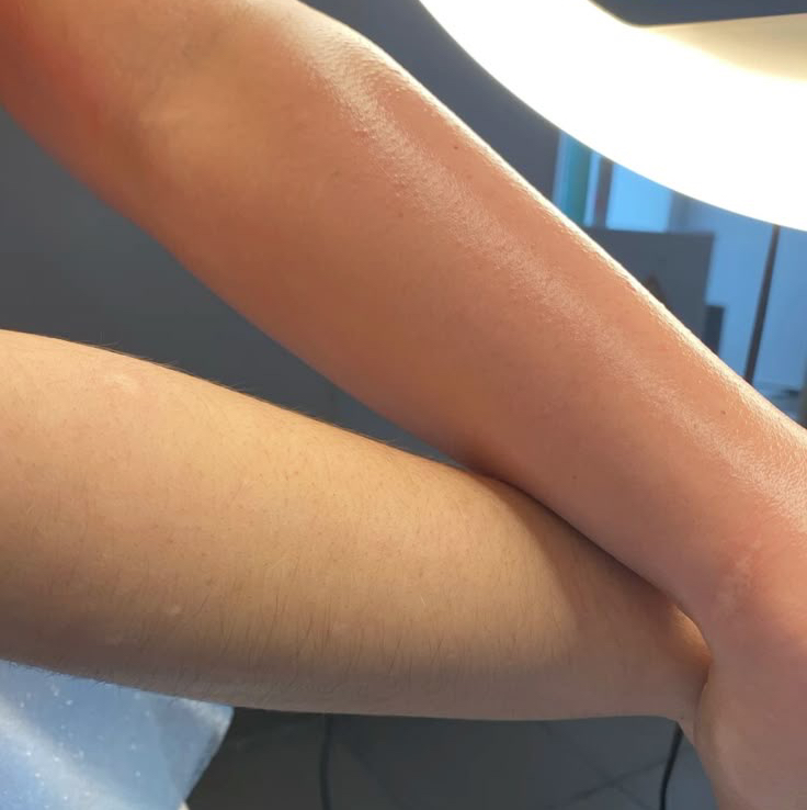 Восковая депиляция Руки полностью