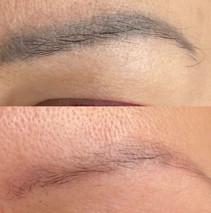 Удаления перманента