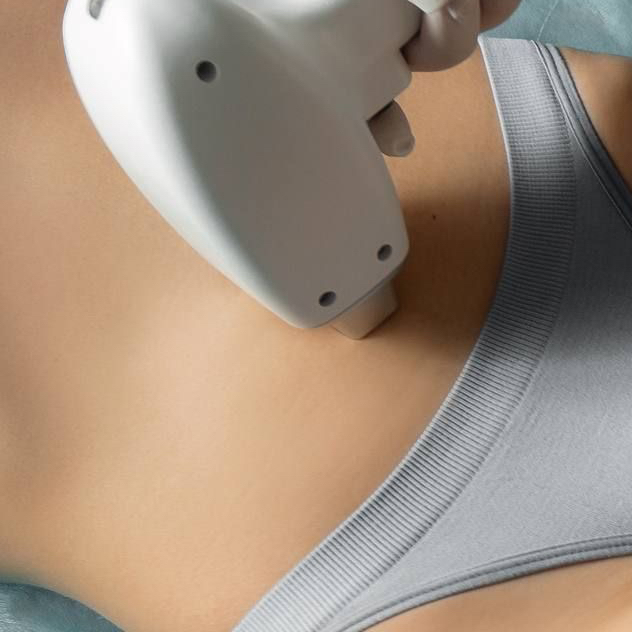 Лазерная эпиляция Бикини классика