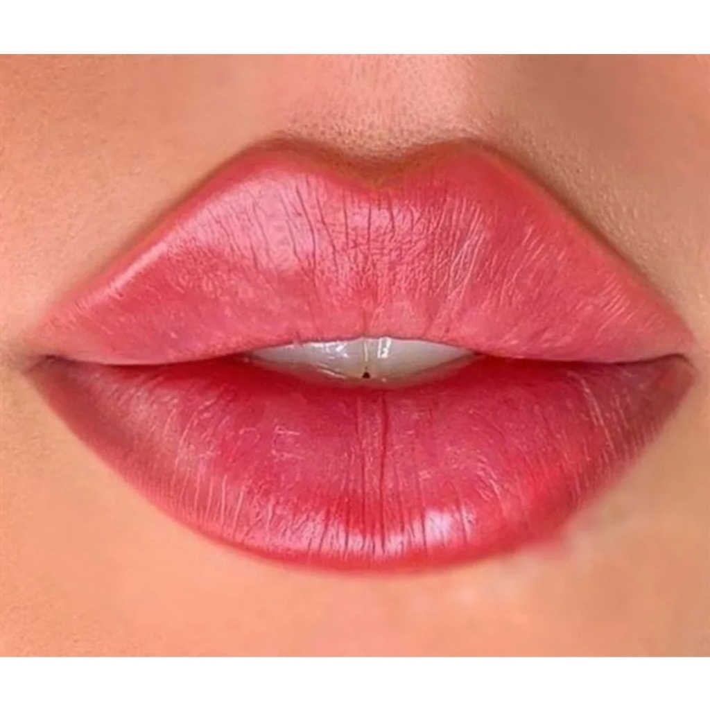 Контурная пластика губ Viscolane lips  1 ml