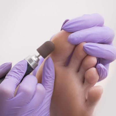 Педикюр гигиенический (обработка стопы)