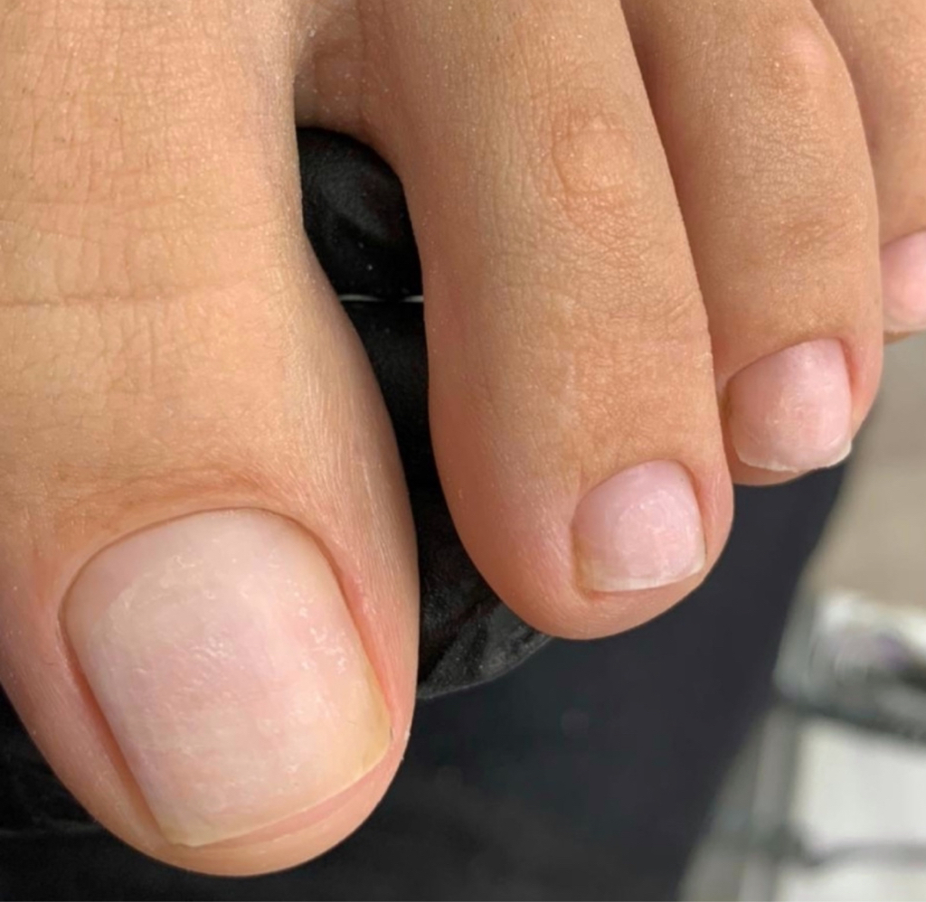 Обработка пальчиков (без покрытия )