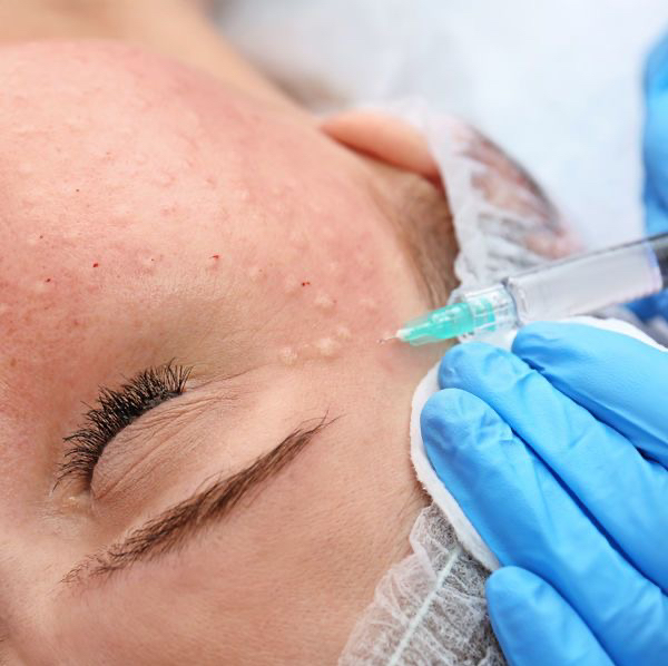 Антивозрастная инъекционная мезотерапия и лифтинг эффект