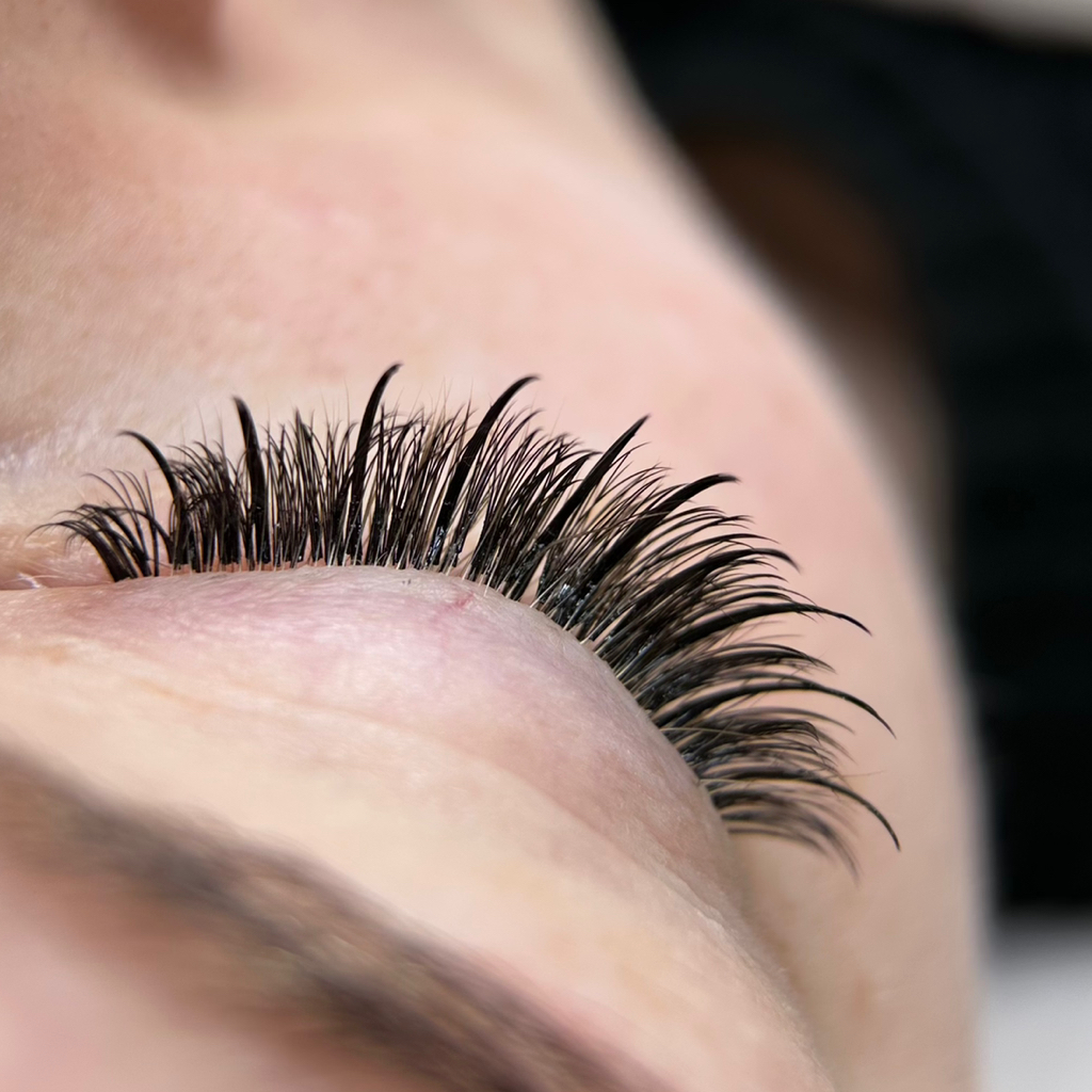 Эффект Ким/Кайли