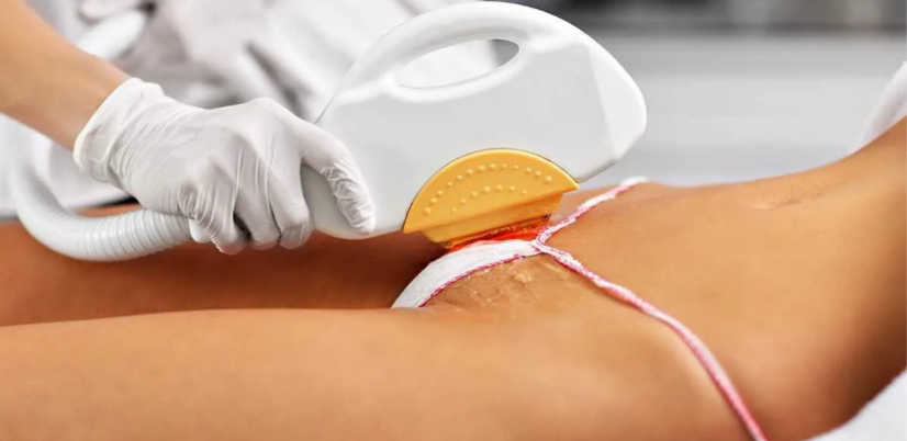 Ноги полностью + глубокое бикини + ПОДМЫШКИ