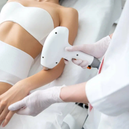 Лазерная эпиляция: руки выше локтя