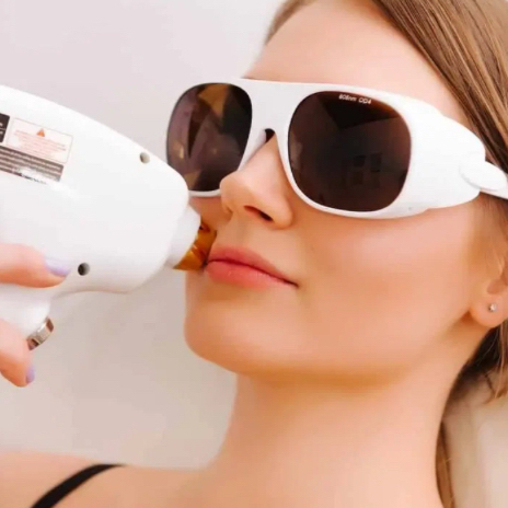 Лазерная эпиляция: верхняя губа