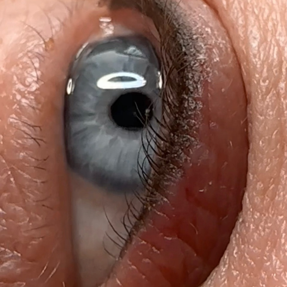 Коррекция перманентного макияжа глаз ( моей работы)