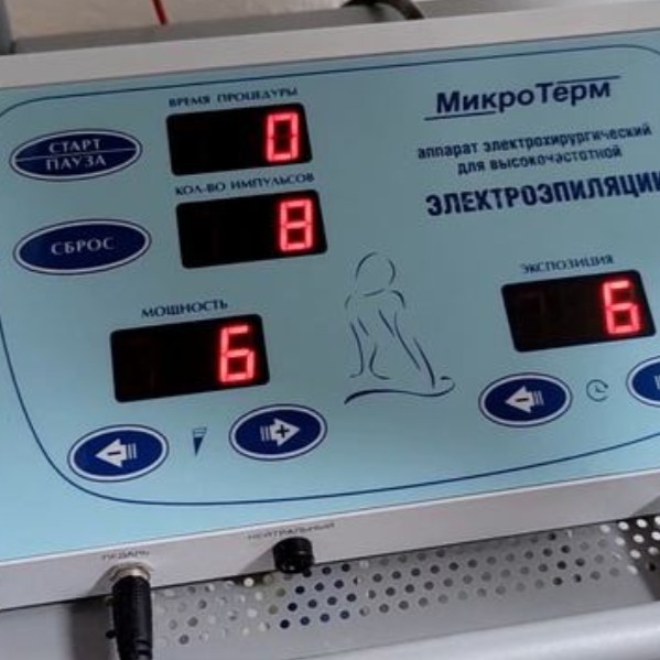электроэпиляция