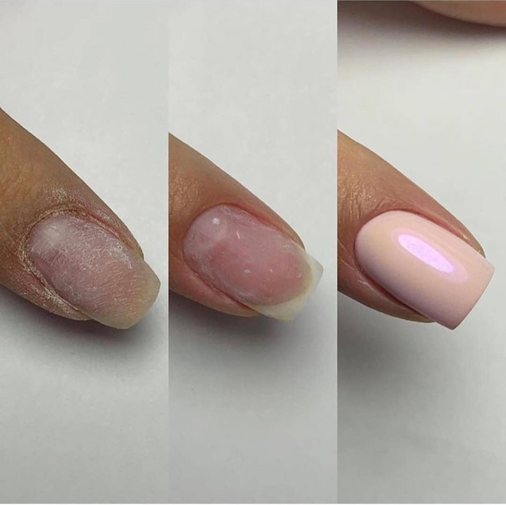 Ремонт одного ногтя