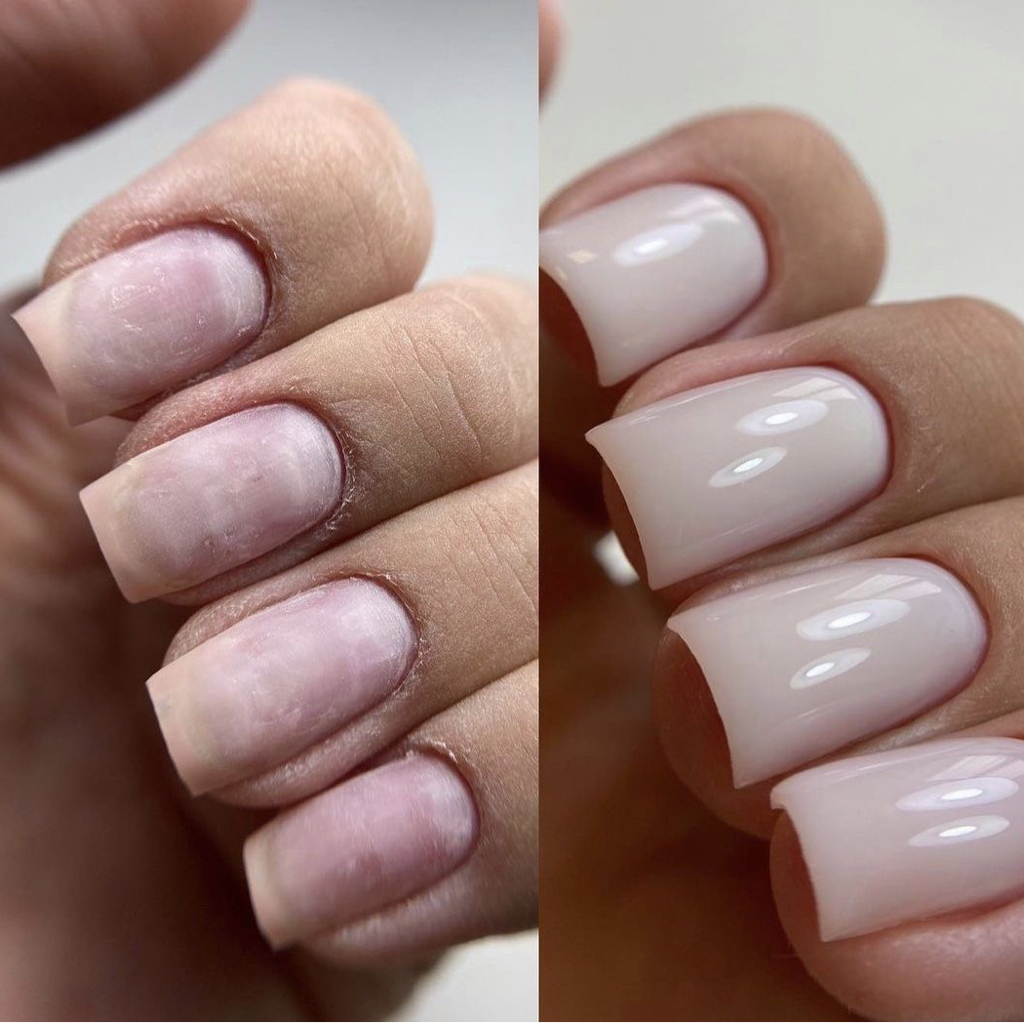 Реставрация ногтей