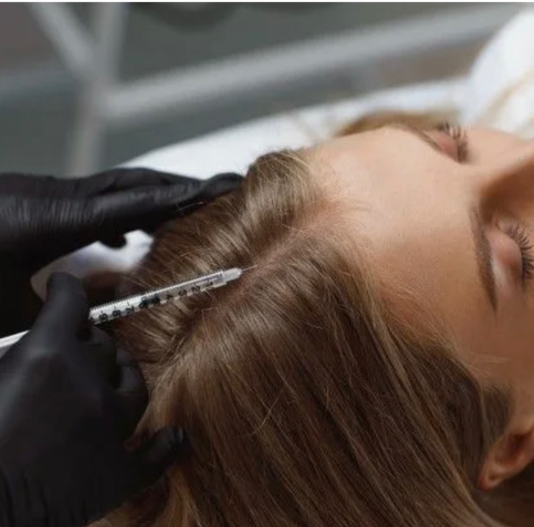 Мезотерапия кожи головы