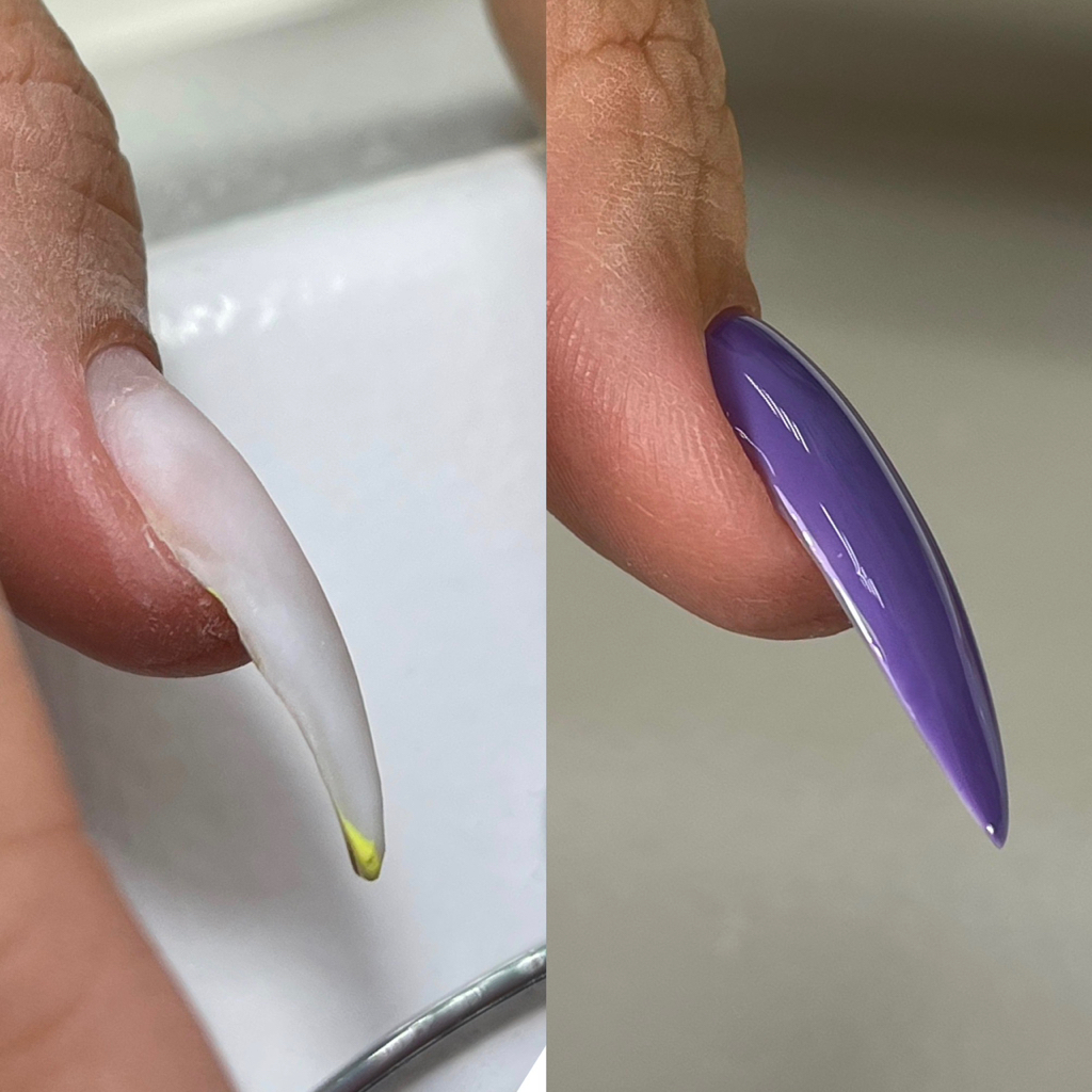 Коррекция ногтей гелем/акригелем (поднятие грифозных (сильно клюющих) ногтей/достраивание всех углов)