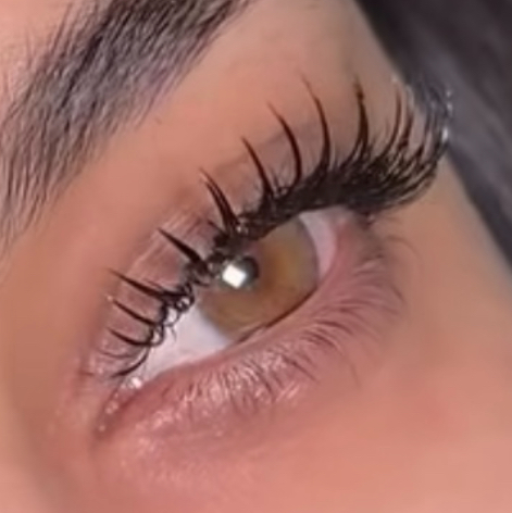 Только лучи