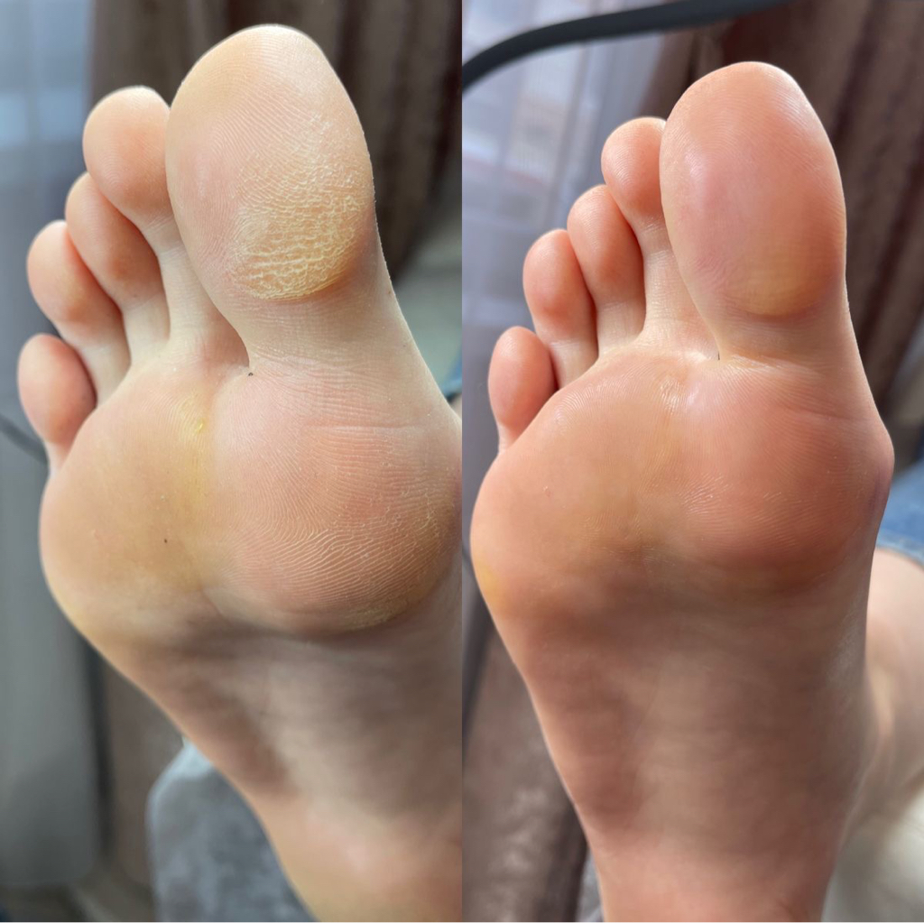 Педикюр с покрытием Golden trace( spa)