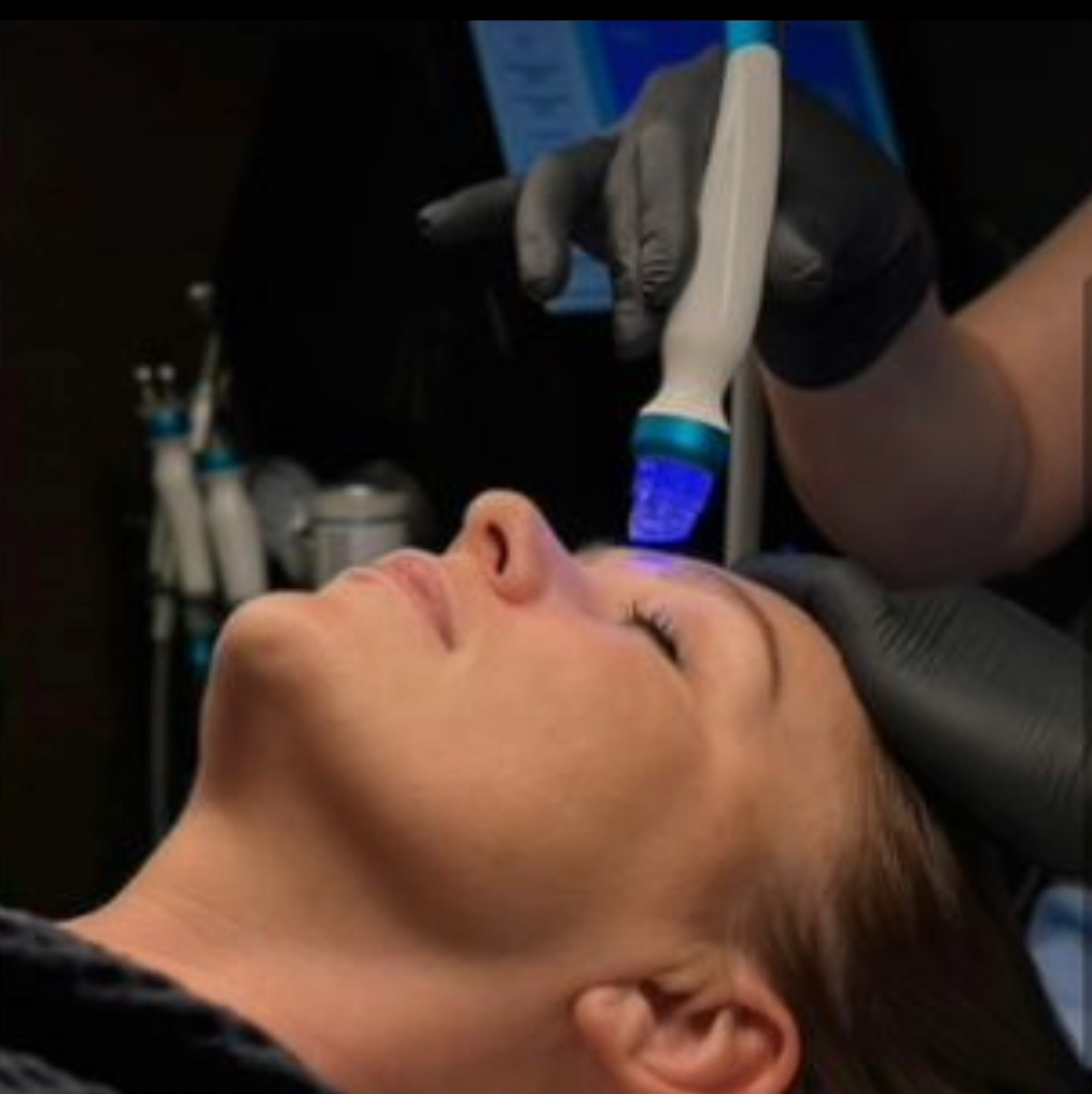 Гидропилинг Hydrafacial /вакуумная чистка лица/