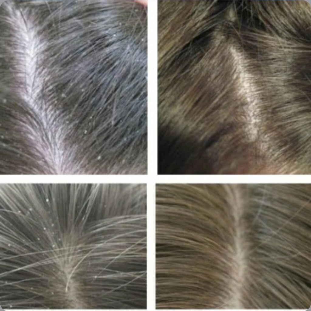 Пилинг кожи головы (совместно с кератин/ботокс)