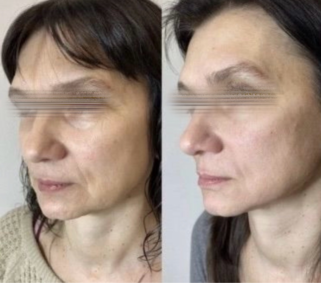 СПЛИТ массаж