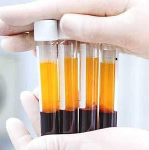 Плазмолифтинг