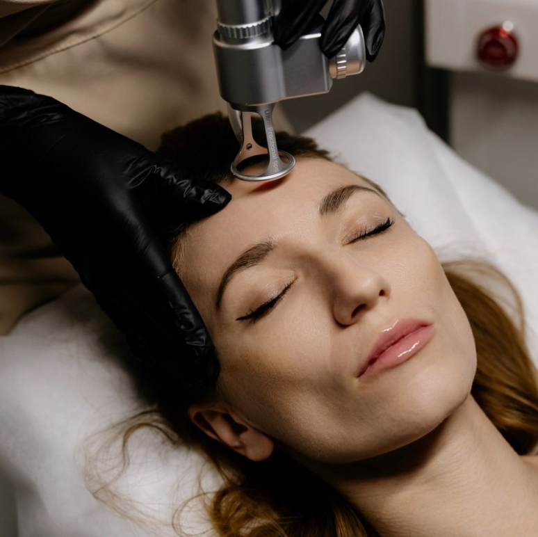 Шлифовка CO2 лицо