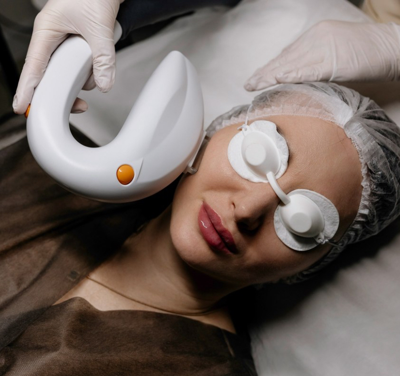 Фотоомоложение IPL M22 Щеки