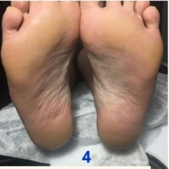 Экспресс-педикюр (пальцы/стопа)