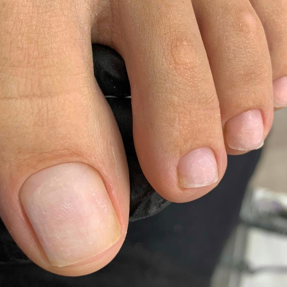 Обработка пальчиков и стоп  (без покрытия)