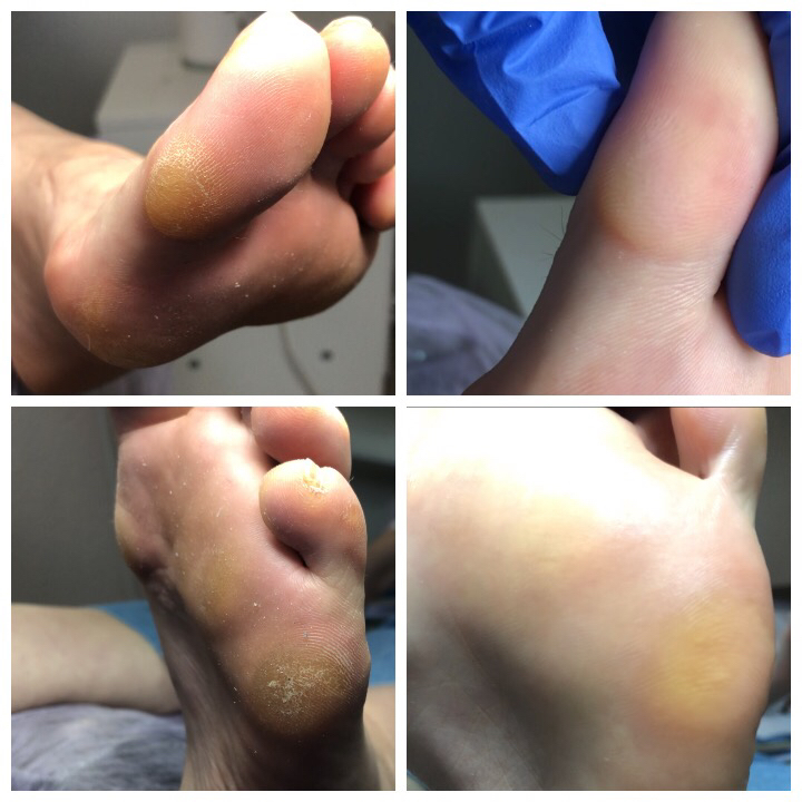 ЭКО-ПЕДИКЮР (без покрытия)