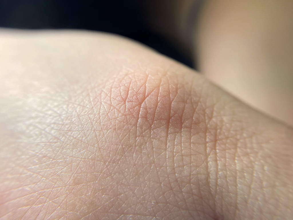 Парафинотерапия для кожи рук