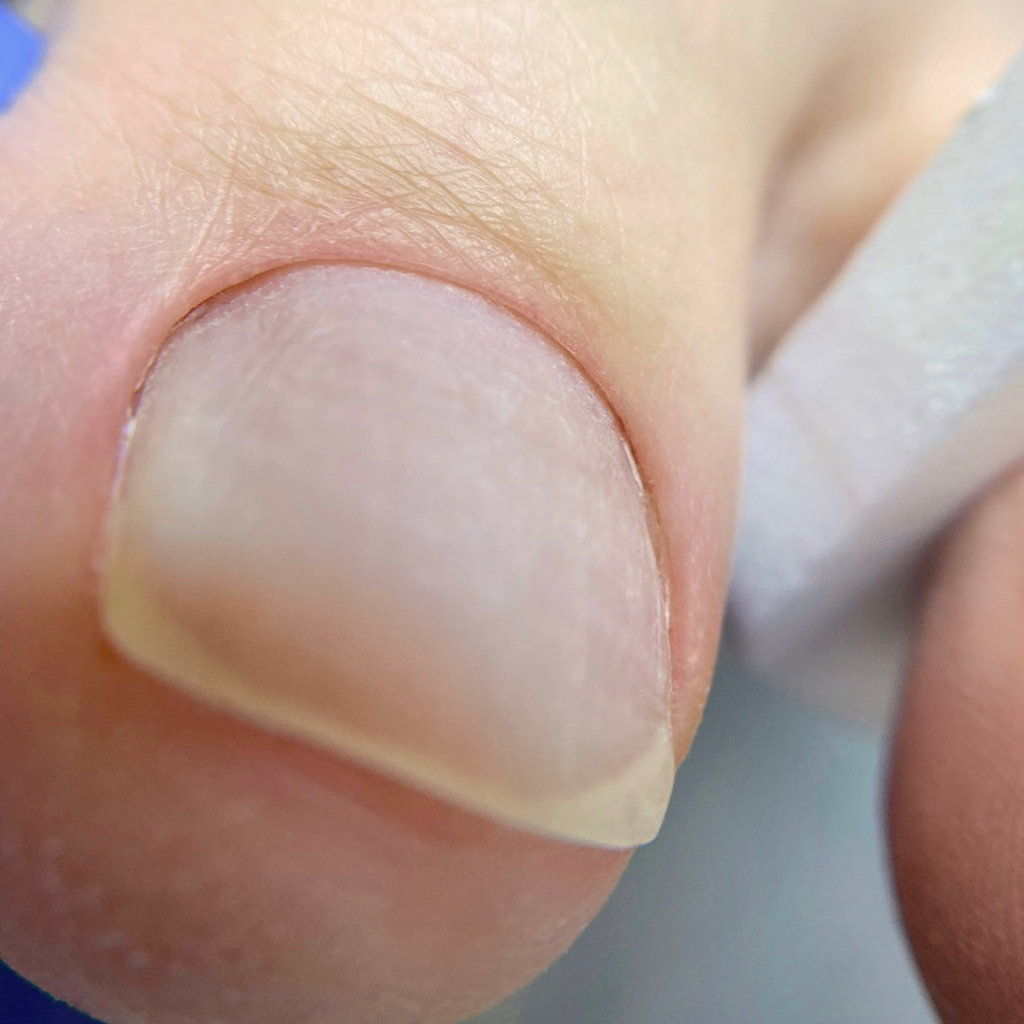 Обработка пальчиков