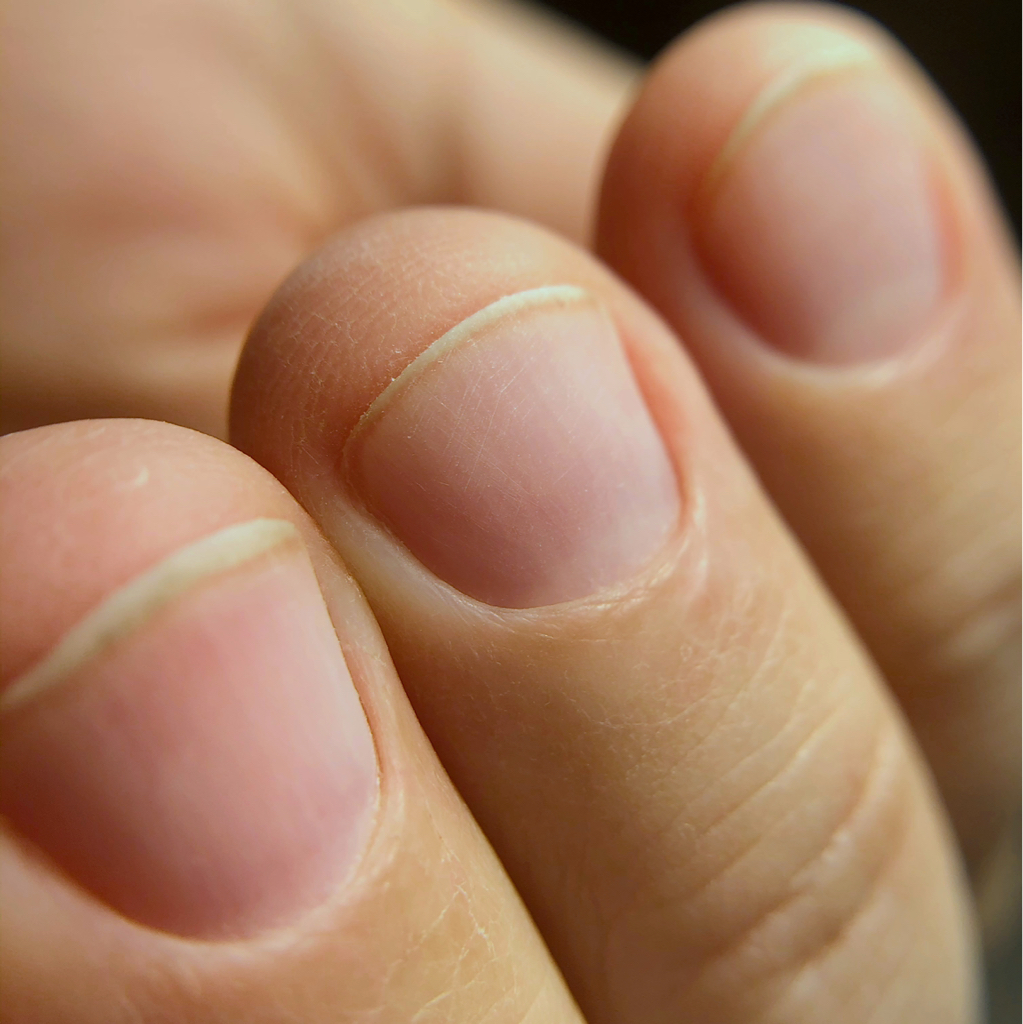 Восстанавливающая система IBX