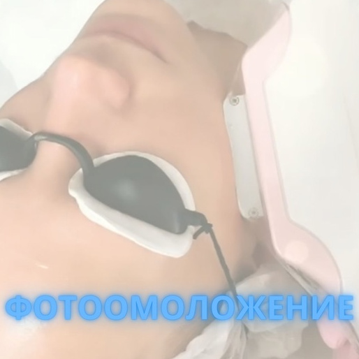 Фотоомоложение